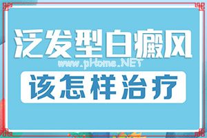 （白风病）治疗脸上白斑的药膏-黑色素移植怎么样
