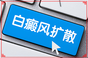 白斑如何治[需要怎么治疗]白殿风怎么治