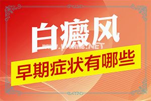治疗白癜风哪个医院好[治疗白斑病应该注意什么]白殿风的最佳治疗
