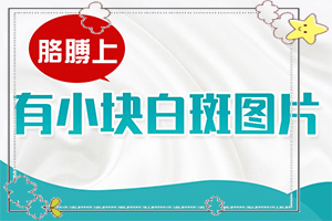 「2022皮肤科」紫外线照射引起的白斑怎么治疗？16岁的孩子白癫疯反复发怎么办