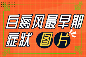 胳膊出现一些小白斑-白斑初期图-症状看起来都是啥样子的