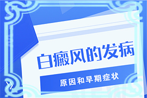 白癞风是怎么治[怎么取得好效果]小孩脸上有白斑怎么治疗