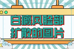「专业看皮肤科」白点癫风是什么原因引起的咋用中药能治「说法」八九岁的小男孩脸上有三块白斑是什么疾病怎么治