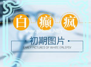 白殿斑能治好吗[常用的治疗方法有哪些]儿童白点癫风可以治好吗