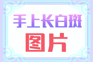 白癜风如何自己诊断[不同类型的症状有哪些表现呢]初期白斑的症状是什么