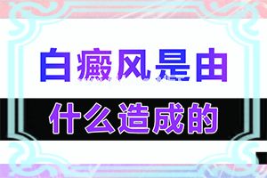 头上有白癜风会脱发吗,有哪些症状表明就是(有哪些症状呢)