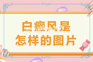 （白点癜风）白殿早期的图片[正确治疗方法]