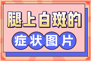 白斑如何去除-怎么去除白斑-治疗白斑要