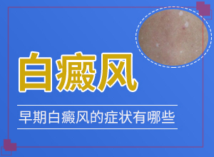 「手指有白点」身体上有一小部分？不同时期的症状有哪些呢