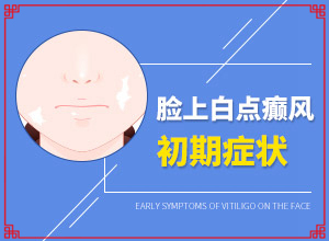 白癜风应做哪些检查-男人身上长白斑点原因-出现的原因是什么