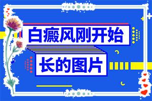 头皮上出现白斑图片？有白斑图片吗-如何自我诊断