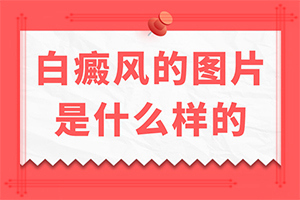 白点癫风初期症状,什么样(症状有哪些)