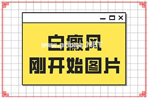 （白风病）治疗脸上白斑的药膏-黑色素移植怎么样