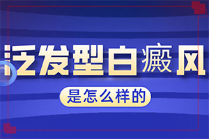 白班病怎样治疗[治疗费用是多少]白癫风可以治好吗