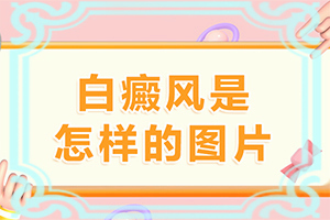 「2022推荐咨询」我想说皮肤用药后留下的白斑怎么治「专业皮肤科」小学生脸上长白斑不好看怎么才能去除