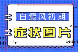 轻度白斑早期症状图片-白点癫风严重的会死人吗