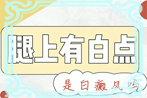 儿童白颠疯病可以治愈吗[怎么医治好呢]治白癫好方法