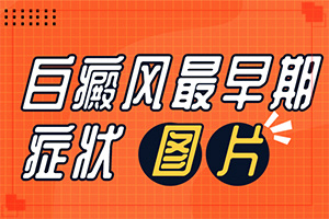孩子大腿上有一块特别白？白癜风有什么症状和检查-有哪些症状表明出现严重情况呢