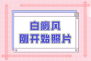 「在这里」白殿风能吗「热点公布」白癜风好治疗吗