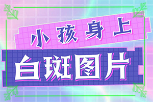 白颠疯可以治吗(治疗要注意哪些)-白治疗的办法