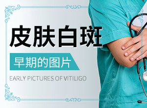 身上一块一块白色的是什么？身上长了很多小白点-怎么检查呢