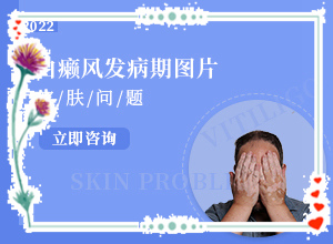 脸上长白斑怎么办图片？好吗
