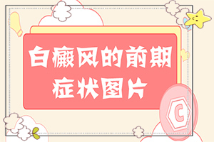 小孩脸上有白颠风,该如何诊断呢(一般有哪些症状呢)