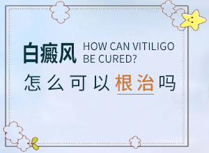 头顶长白发是什么原因引起的呢图片