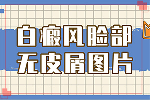  头部皮肤皮肤变白斑的原因造成的