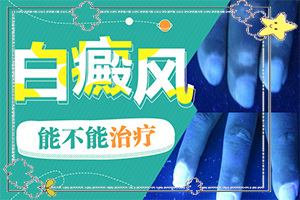 白癞风的症状,要做什么检查(有哪些症状表明出现严重情况呢)