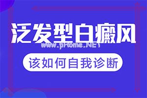白癫的治疗有效医院[如何治疗效果好]儿童白癞风能治好吗