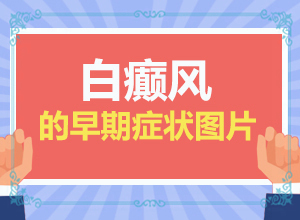 小孩白殿疯好治吗？治疗的方式是什么