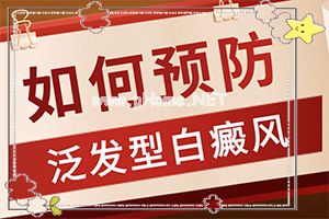 哪家医院看白癫风好-治疗白斑怎么做[方法推荐]